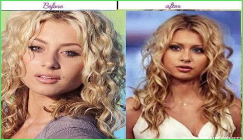 Aly Michalka Plastic Surgery Before and After