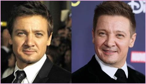 Jeremy Renner Plastic Surgery Before and After 